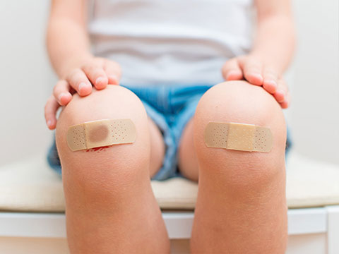 image of child with scraped knees